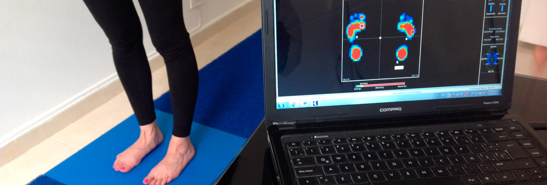 analisis huella plantar en Boyaca