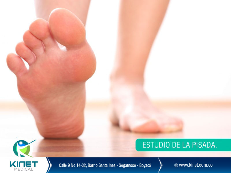 Estudio de la pisada y del pie