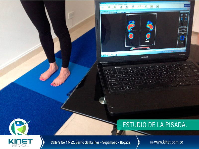 Análisis de huella plantar estudio de la pisada